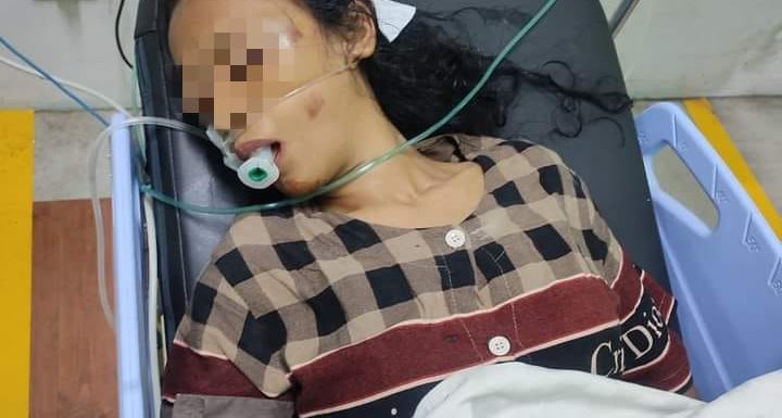 Viral Korban Diduga Kecelakaan Tanpa Identitas Ada di Rumah Sakit Umum Demang Sepulau Raya Lampung Tengah